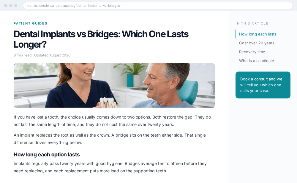 Published article on the Northshore Dental blog titled Dental Implants vs Bridges: Which One Lasts Longer? with an in-article contents list and a book a consult call to action.